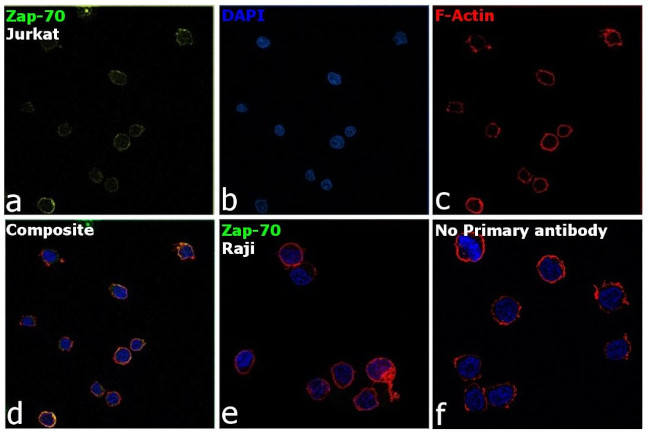 Zap-70 Antibody in Immunocytochemistry (ICC/IF)