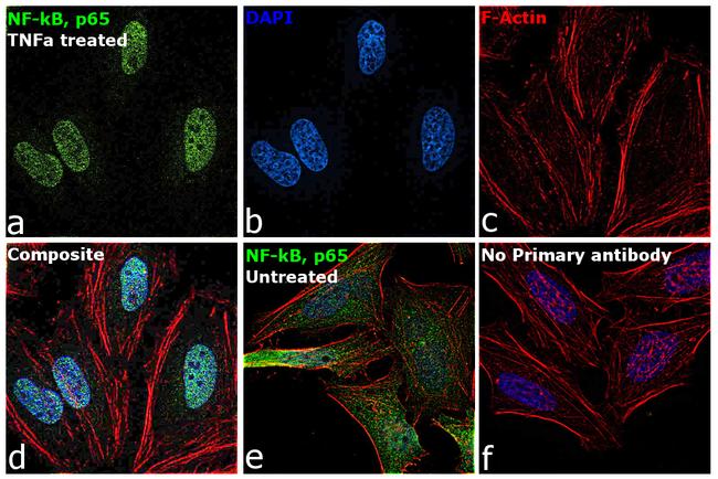 NFkB p65 Antibody