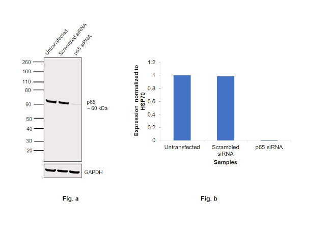 NFkB p65 Antibody