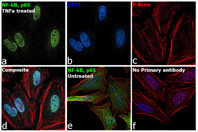 NFkB p65 Antibody in Immunocytochemistry (ICC/IF)