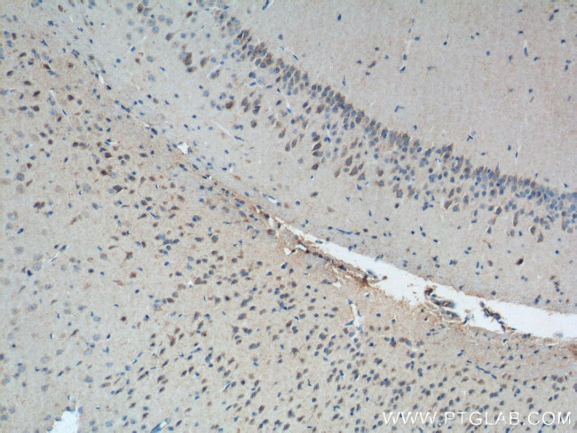 ATP5A1 Antibody in Immunohistochemistry (Paraffin) (IHC (P))