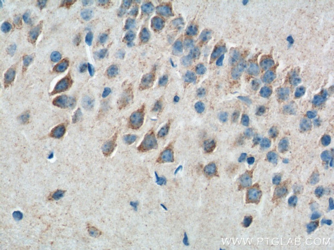 ATP5A1 Antibody in Immunohistochemistry (Paraffin) (IHC (P))