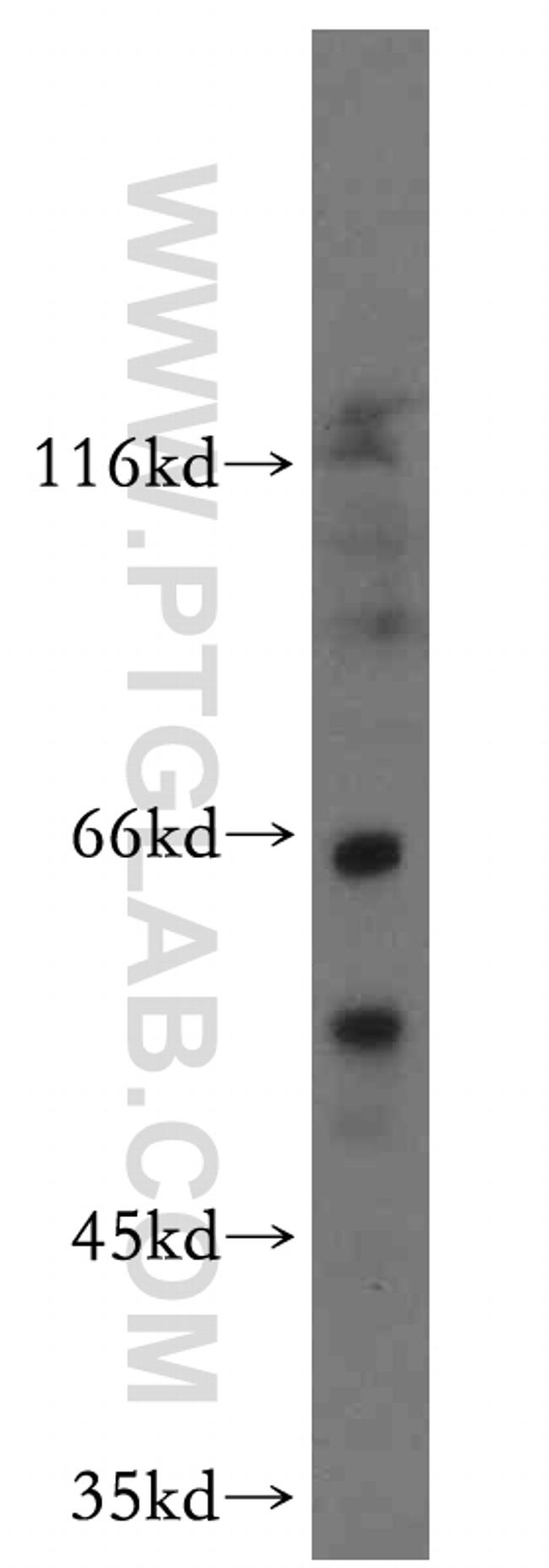 ATP5A1 Antibody in Western Blot (WB)