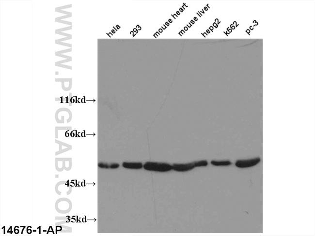 ATP5A1 Antibody in Western Blot (WB)