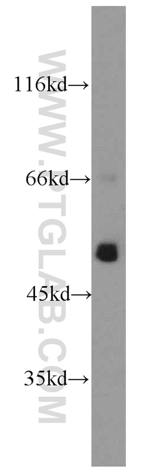 ATP5A1 Antibody in Western Blot (WB)