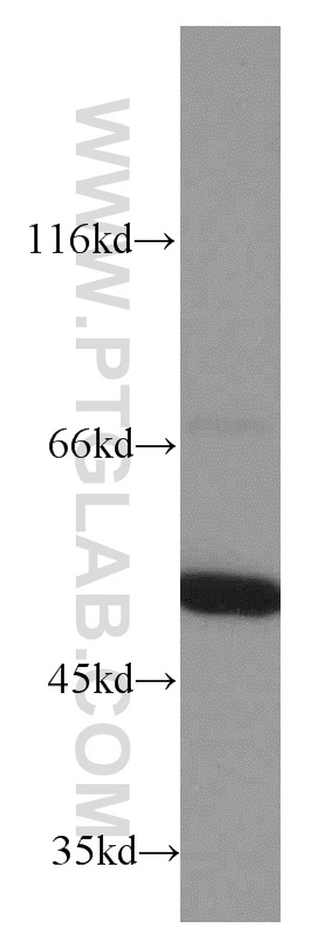 ATP5A1 Antibody in Western Blot (WB)