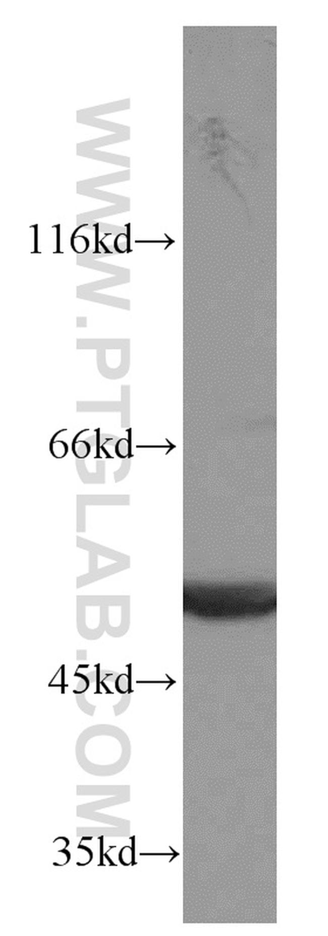 ATP5A1 Antibody in Western Blot (WB)