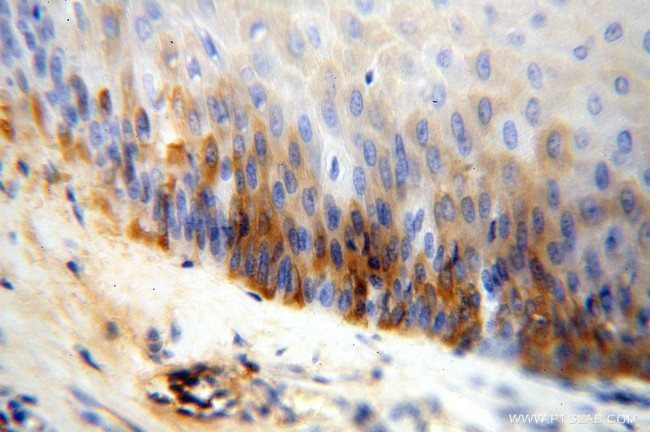 IgG light chain (Kappa) Antibody in Immunohistochemistry (Paraffin) (IHC (P))