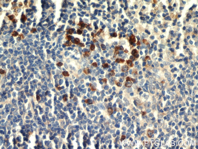 IgG light chain (Kappa) Antibody in Immunohistochemistry (Paraffin) (IHC (P))