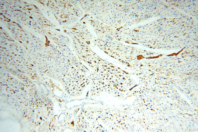 IgG light chain (Kappa) Antibody in Immunohistochemistry (Paraffin) (IHC (P))