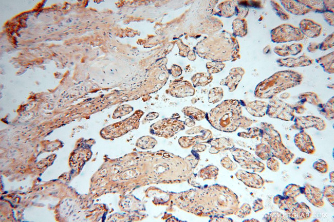 IgG light chain (Kappa) Antibody in Immunohistochemistry (Paraffin) (IHC (P))