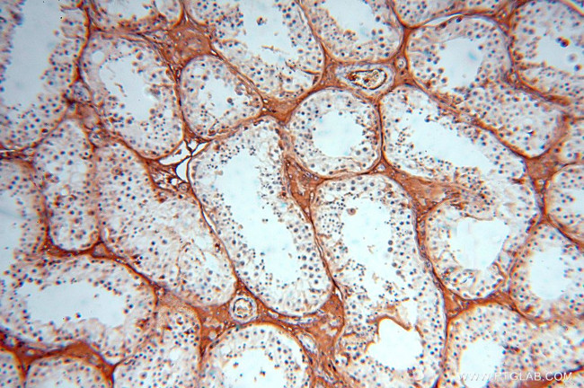 IgG light chain (Kappa) Antibody in Immunohistochemistry (Paraffin) (IHC (P))