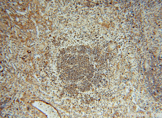 IgG light chain (Kappa) Antibody in Immunohistochemistry (Paraffin) (IHC (P))