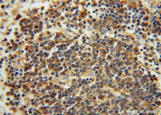 IgG light chain (Kappa) Antibody in Immunohistochemistry (Paraffin) (IHC (P))