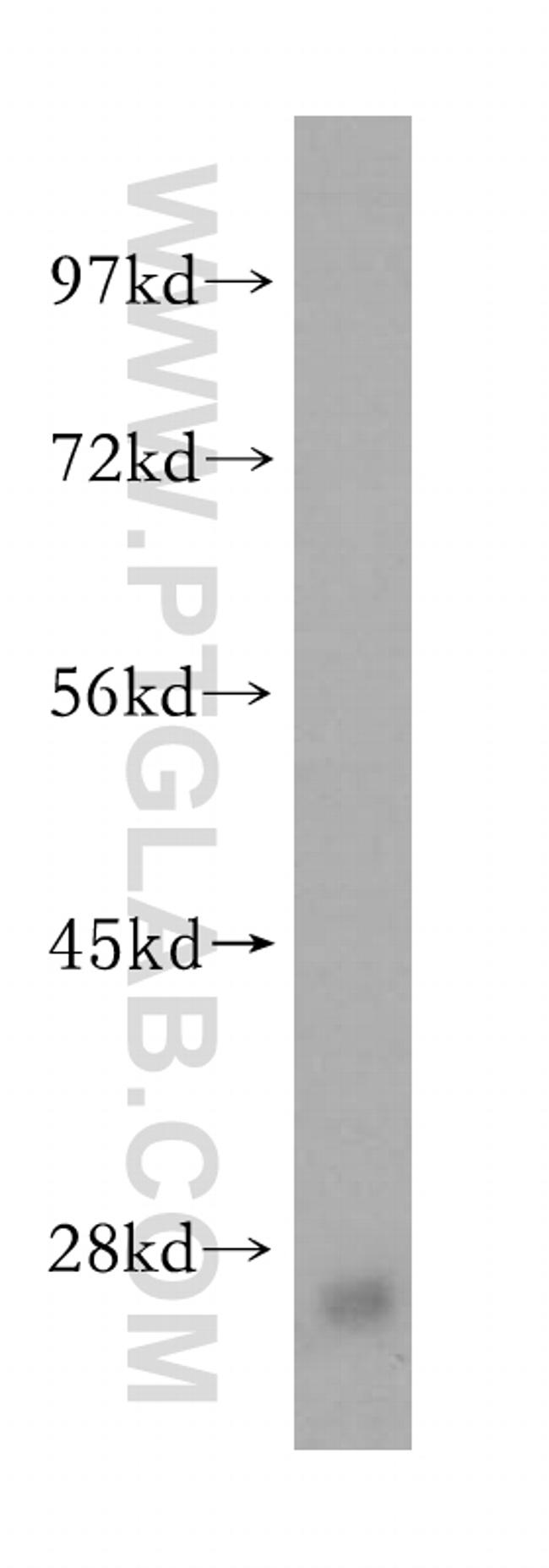 IgG light chain (Kappa) Antibody in Western Blot (WB)