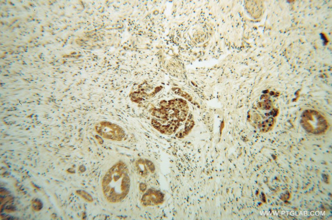 ZADH2 Antibody in Immunohistochemistry (Paraffin) (IHC (P))