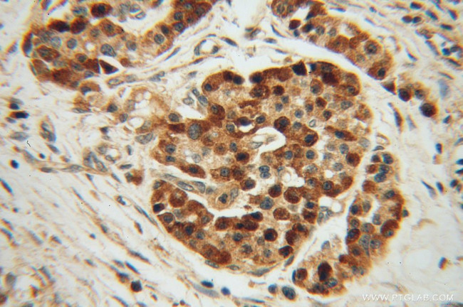 ZADH2 Antibody in Immunohistochemistry (Paraffin) (IHC (P))