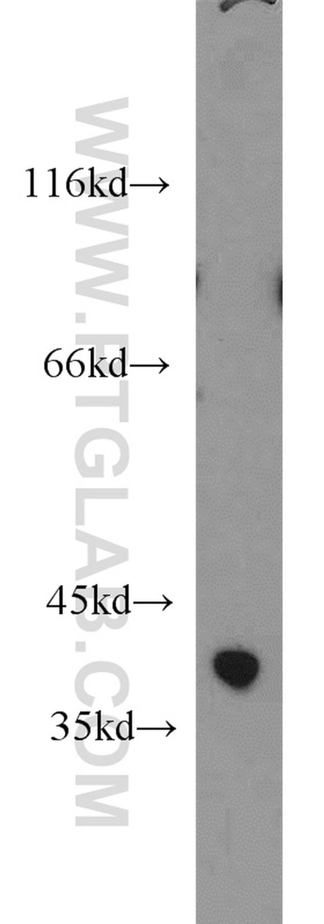 ZADH2 Antibody in Western Blot (WB)