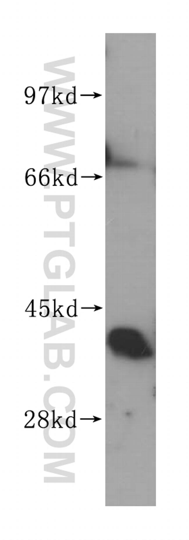 ZADH2 Antibody in Western Blot (WB)