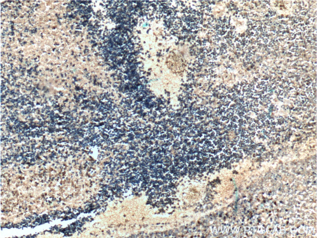 ASNS Antibody in Immunohistochemistry (Paraffin) (IHC (P))