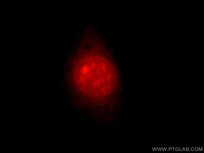 MTA3 Antibody in Immunocytochemistry (ICC/IF)