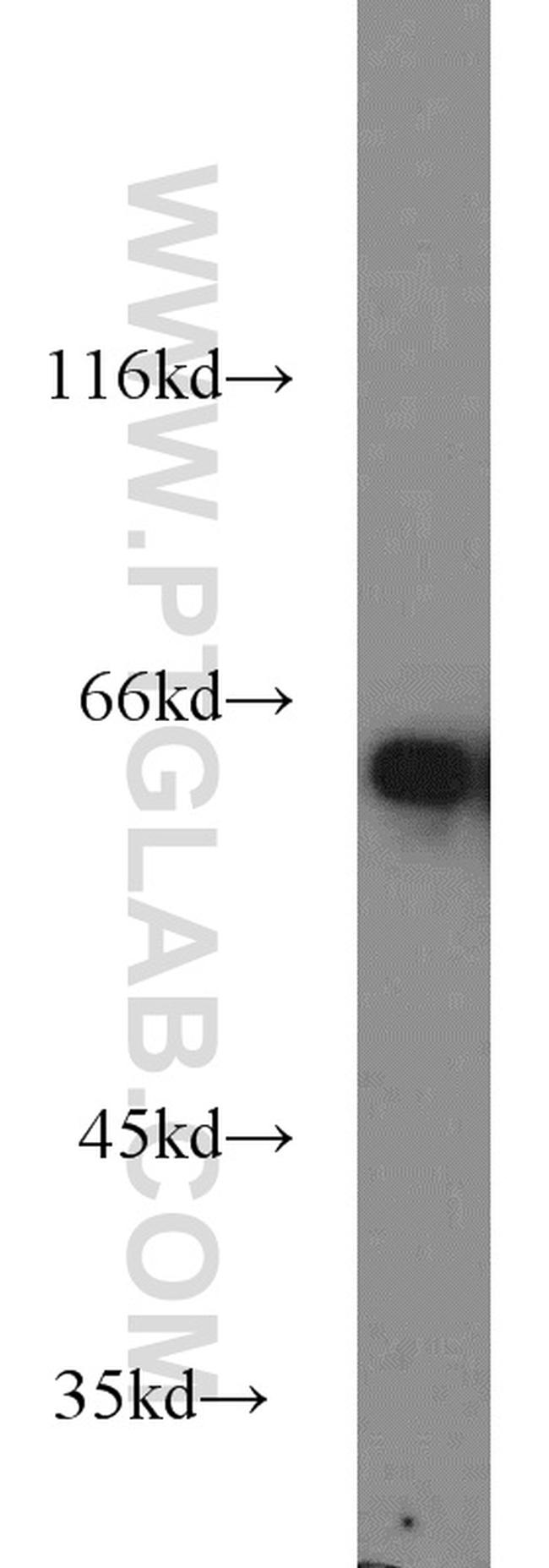 MTA3 Antibody in Western Blot (WB)