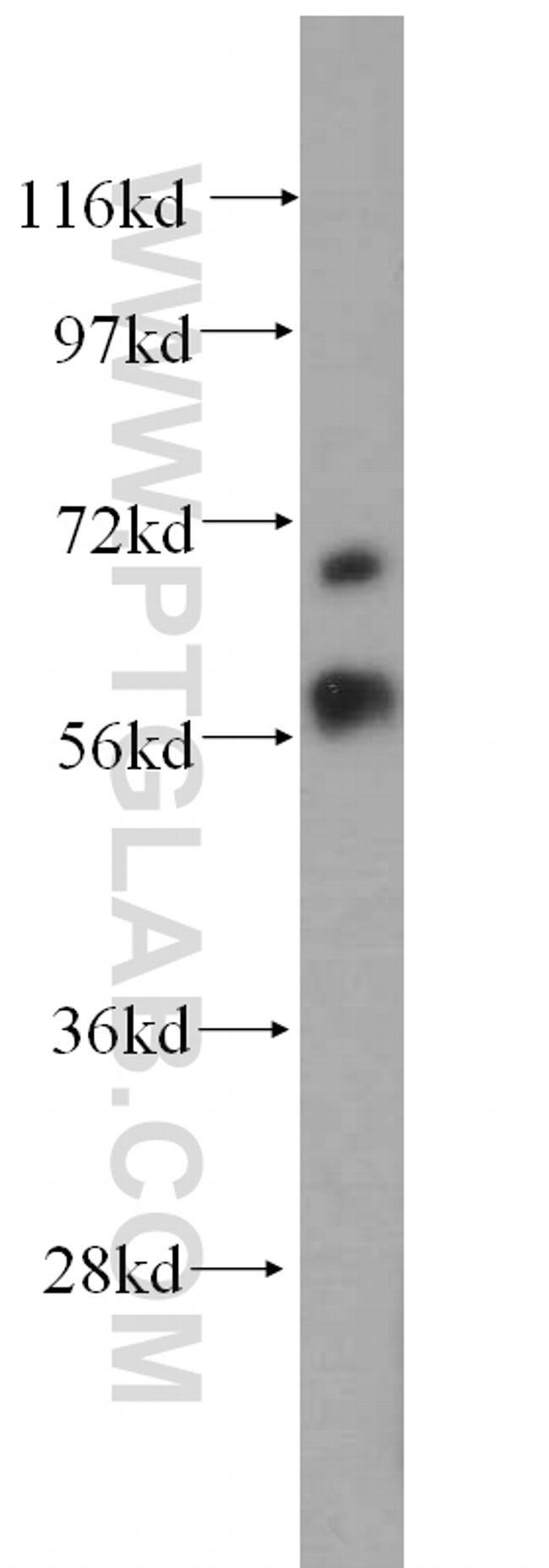 MTA3 Antibody in Western Blot (WB)