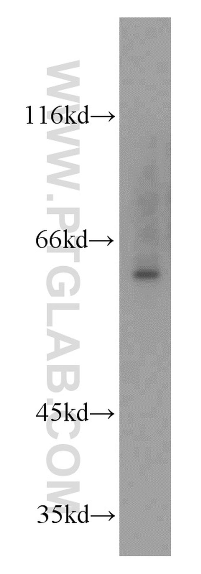 MTA3 Antibody in Western Blot (WB)