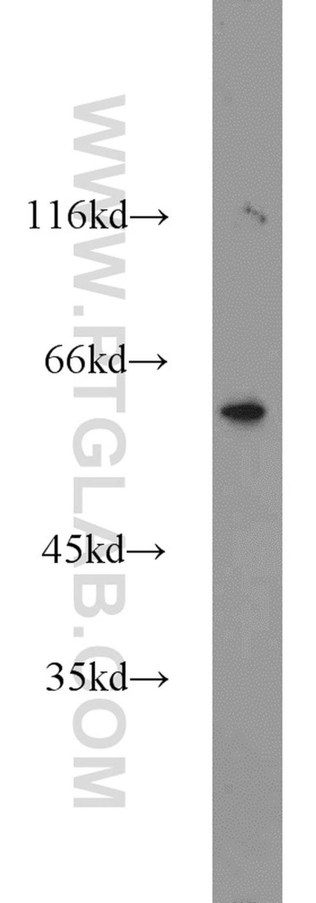 MTA3 Antibody in Western Blot (WB)