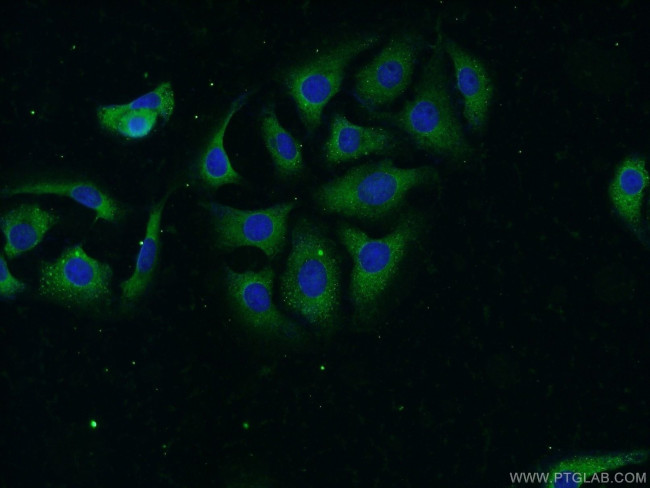 NBAS Antibody in Immunocytochemistry (ICC/IF)