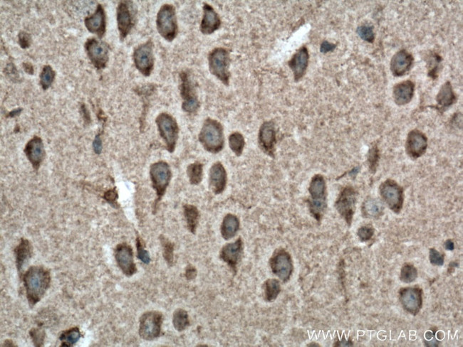 NBAS Antibody in Immunohistochemistry (Paraffin) (IHC (P))