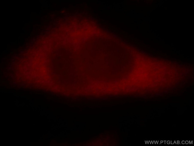 PAK4 Antibody in Immunocytochemistry (ICC/IF)