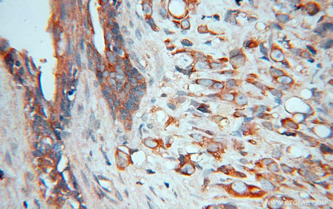 PAK4 Antibody in Immunohistochemistry (Paraffin) (IHC (P))