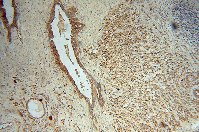 PAK4 Antibody in Immunohistochemistry (Paraffin) (IHC (P))