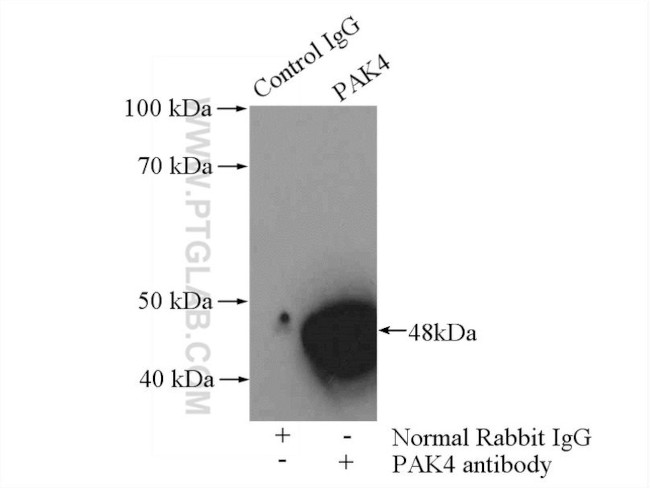 PAK4 Antibody in Immunoprecipitation (IP)