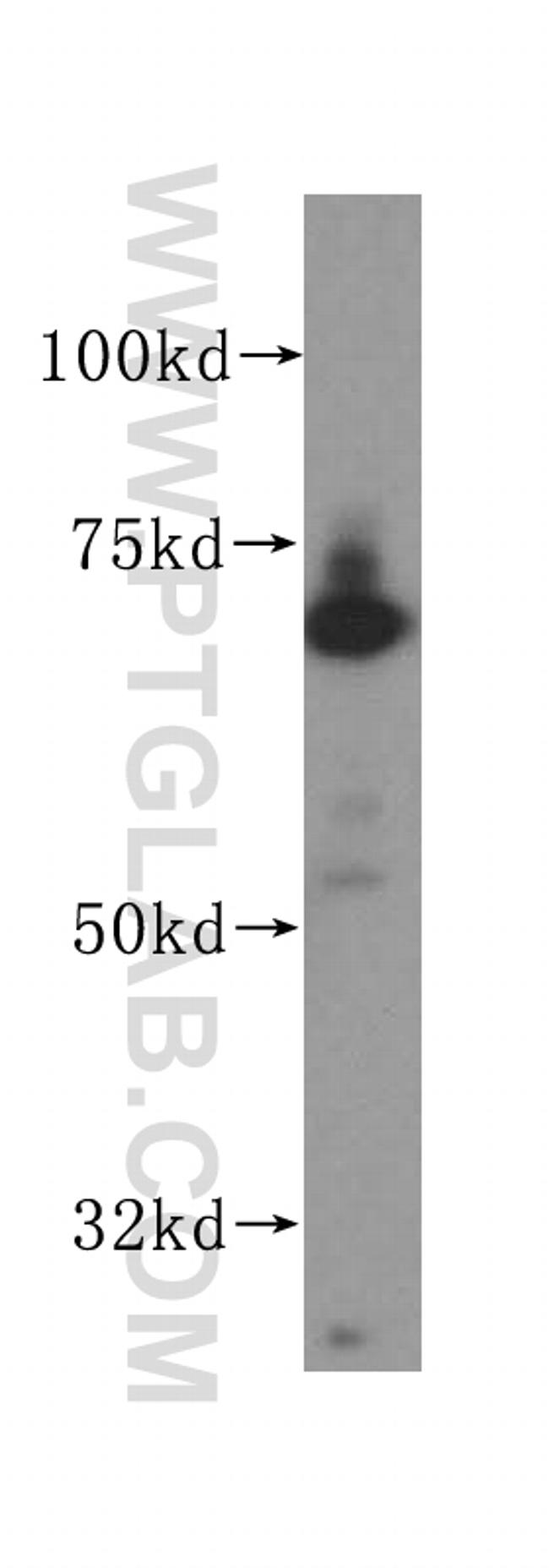 PAK4 Antibody in Western Blot (WB)