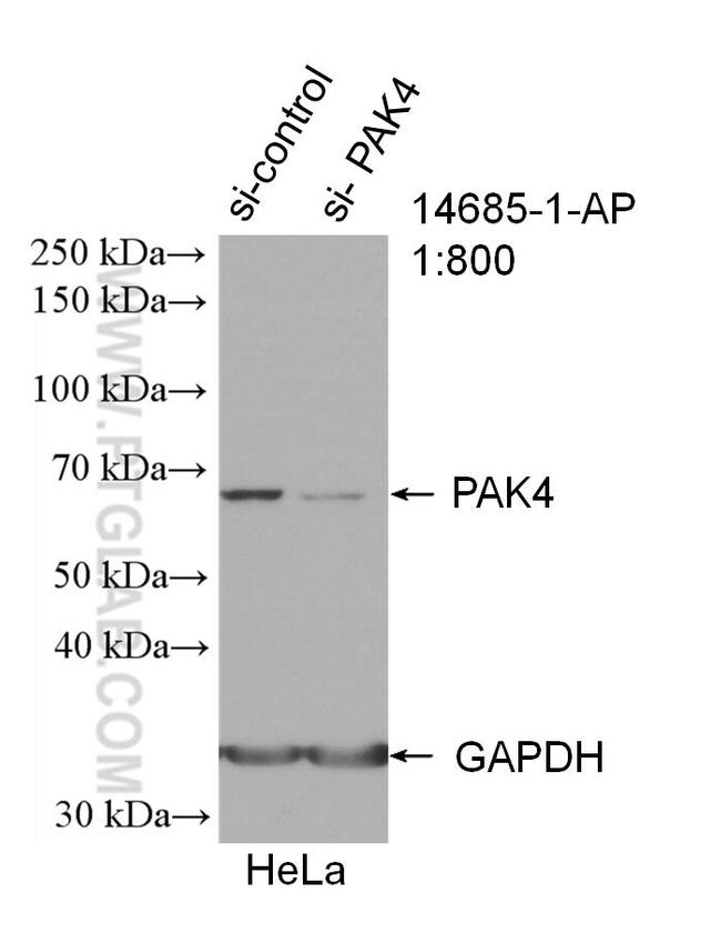 PAK4 Antibody in Western Blot (WB)