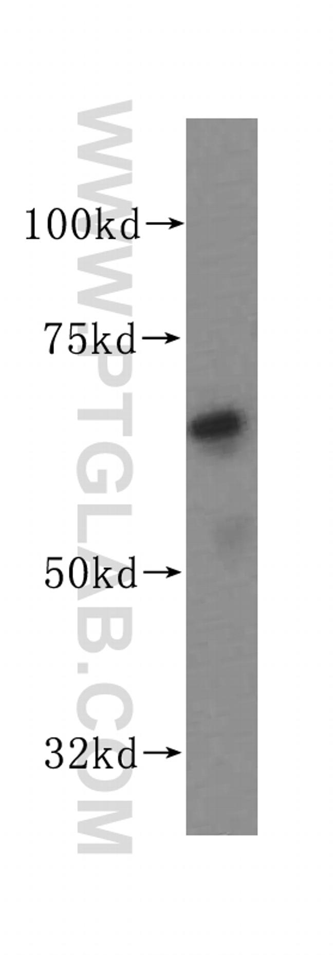 PAK4 Antibody in Western Blot (WB)