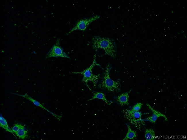 CRMP2 Antibody in Immunocytochemistry (ICC/IF)