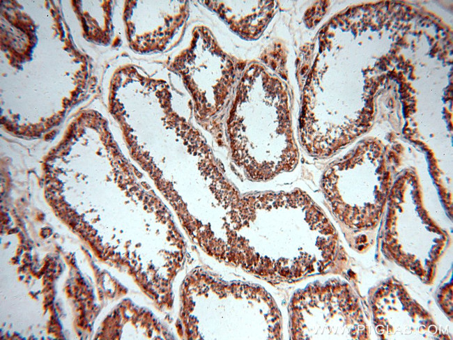 CRMP2 Antibody in Immunohistochemistry (Paraffin) (IHC (P))