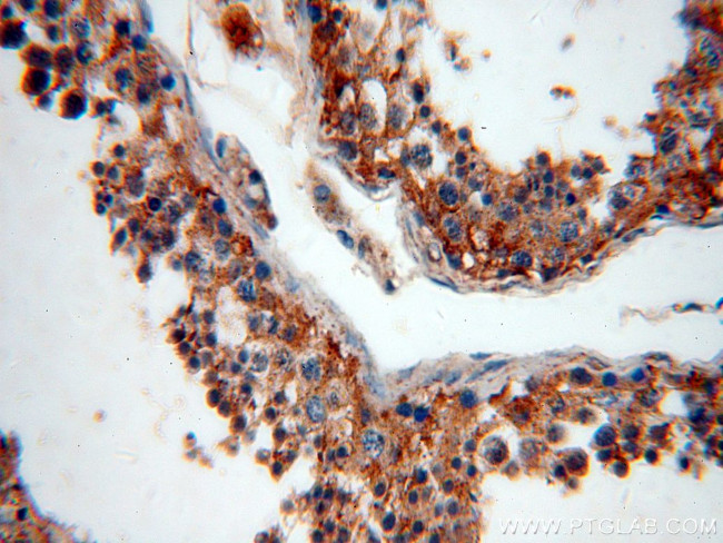 CRMP2 Antibody in Immunohistochemistry (Paraffin) (IHC (P))