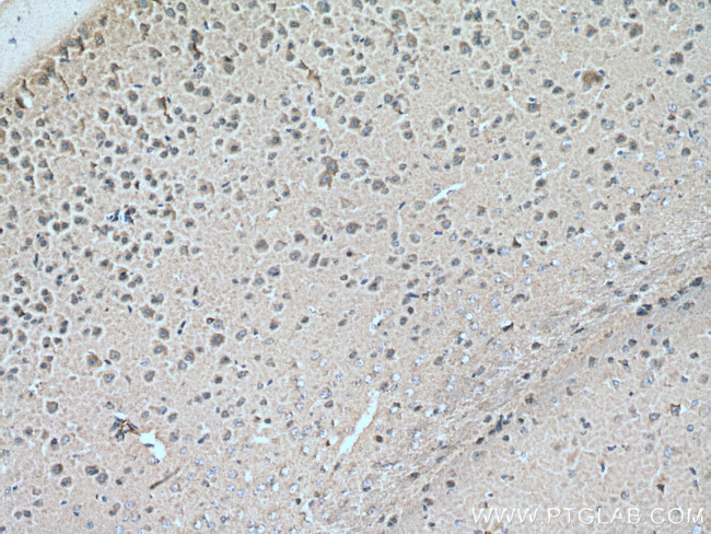 CRMP2 Antibody in Immunohistochemistry (Paraffin) (IHC (P))