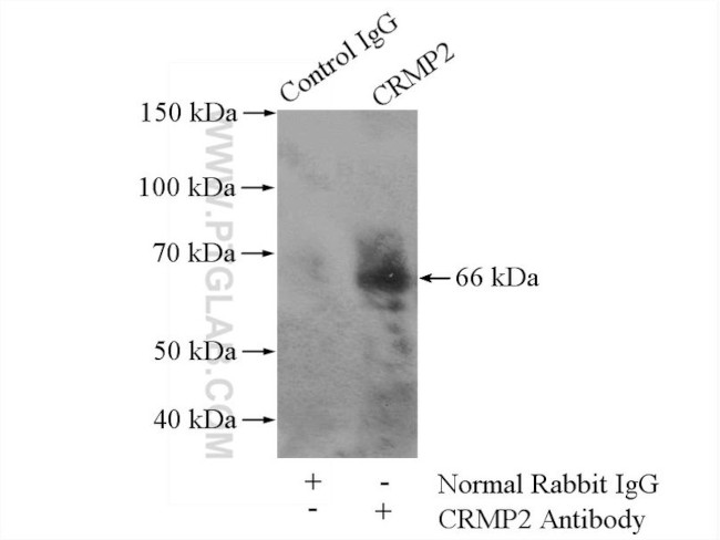 CRMP2 Antibody in Immunoprecipitation (IP)