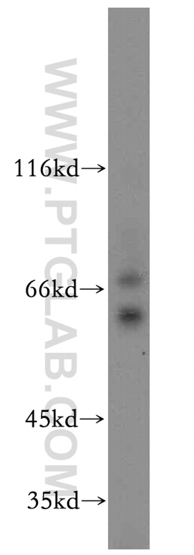 CRMP2 Antibody in Western Blot (WB)