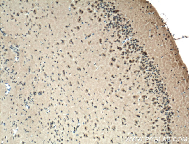 SLC44A1 Antibody in Immunohistochemistry (Paraffin) (IHC (P))