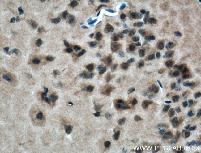 SLC44A1 Antibody in Immunohistochemistry (Paraffin) (IHC (P))