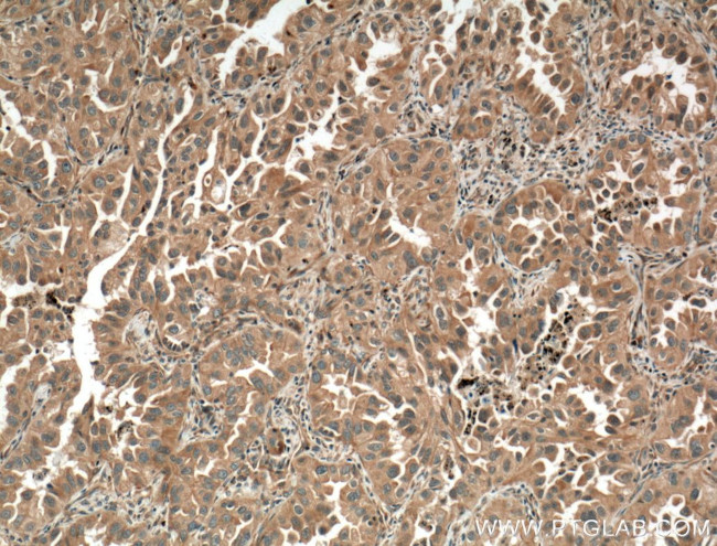 SLC44A1 Antibody in Immunohistochemistry (Paraffin) (IHC (P))