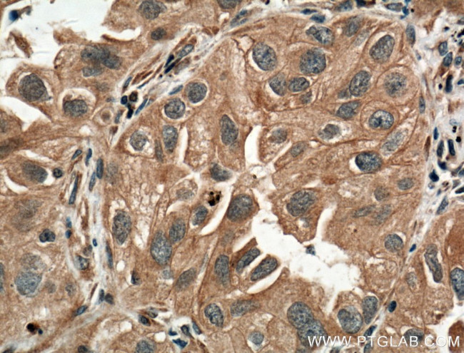 SLC44A1 Antibody in Immunohistochemistry (Paraffin) (IHC (P))