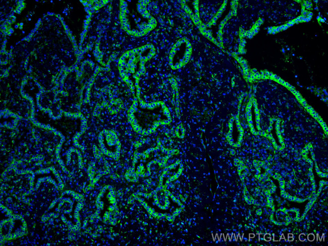 SLC44A1 Antibody in Immunohistochemistry (PFA fixed) (IHC (PFA))