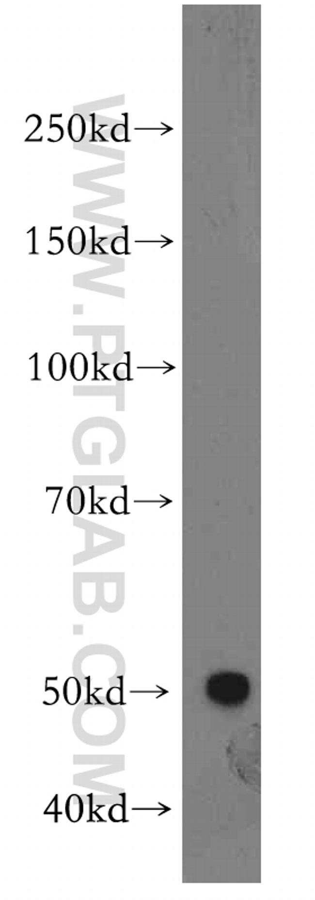 SLC44A1 Antibody in Western Blot (WB)